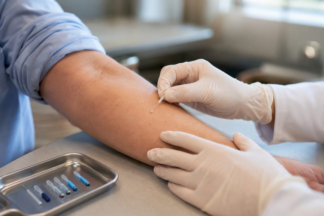 Huidpriktest voor allergie tegen huisstofmijt